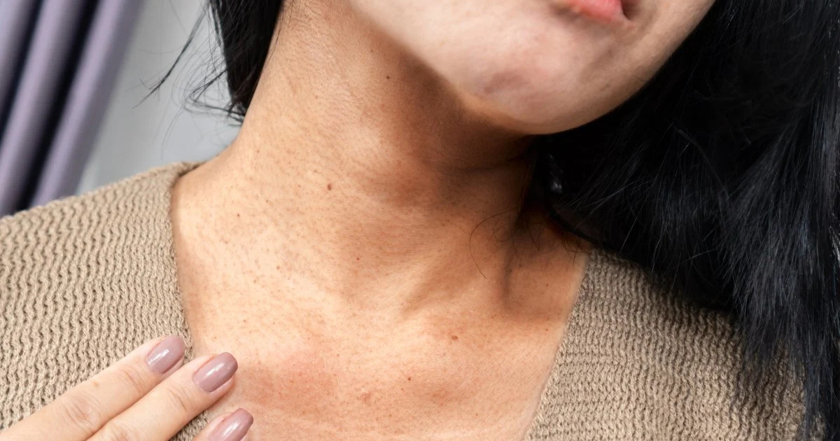 Teenager noticing neck lines, learning causes and natural prevention tips.